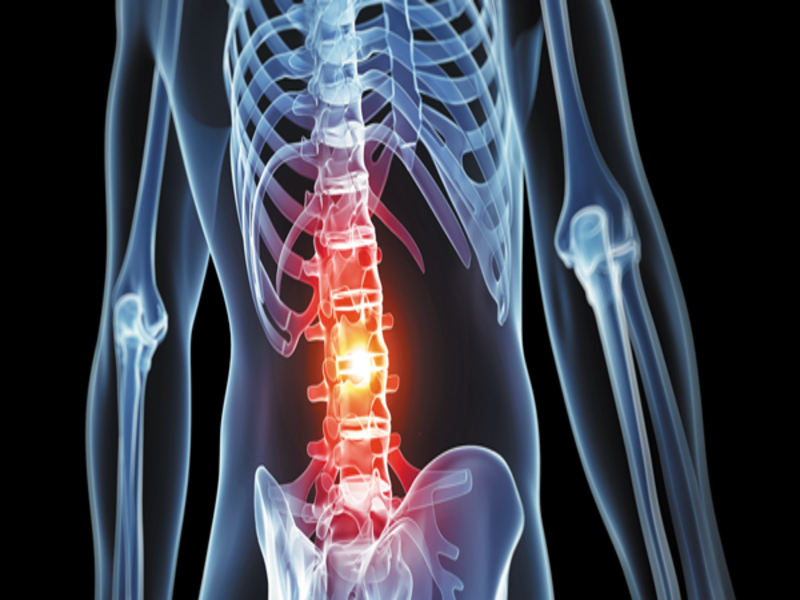 back pain prevention program