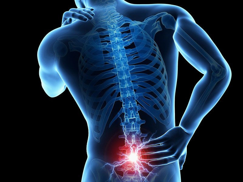 back pain and scatica