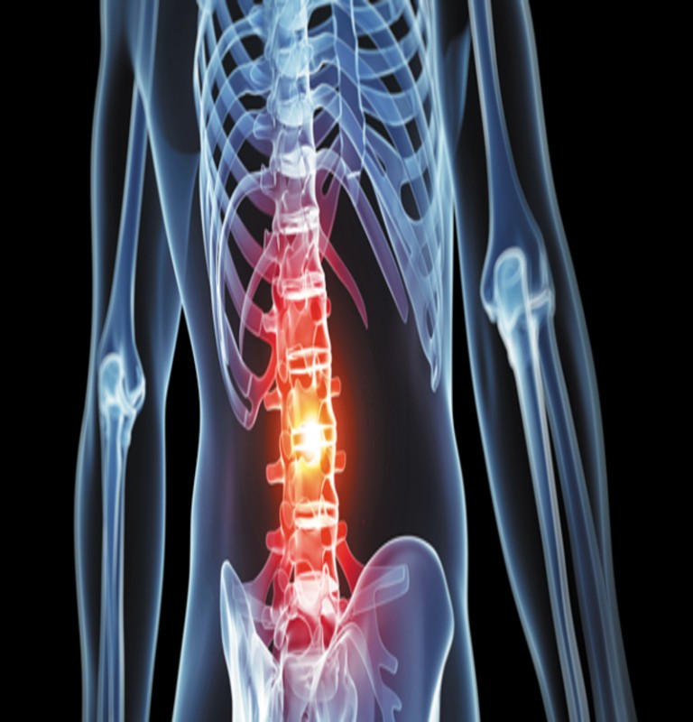 Back Pain Prevention Program