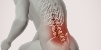 Understanding Cervical & Lumbar Disc Prolapse​