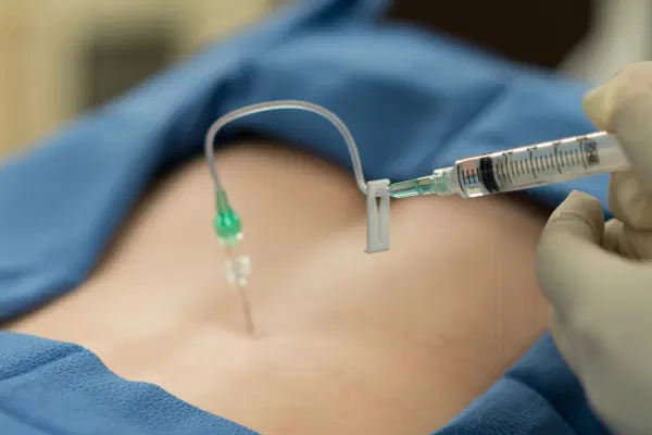 Image-Guided Spinal Injections​