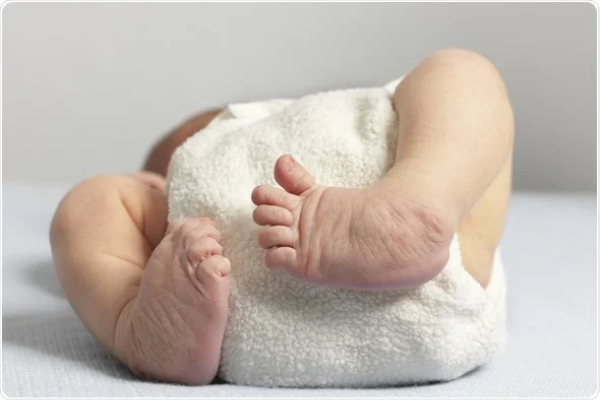 Congenital deformities