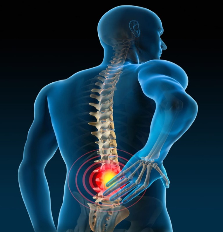 Pain Procedures for Spine Conditions