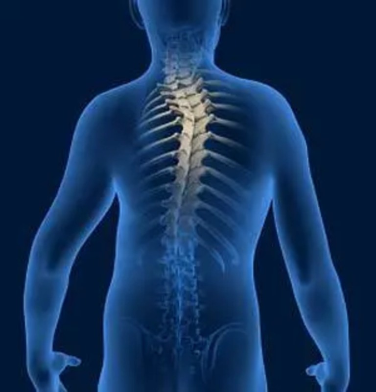 Scoliosis and Kyphosis