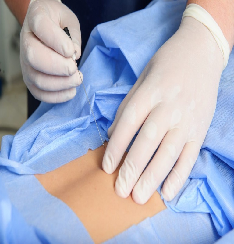 Spinal Injections