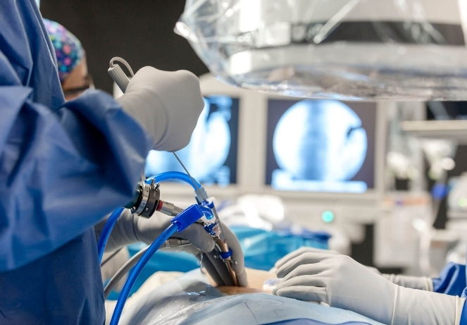 Full Endoscopic Spine Surgery