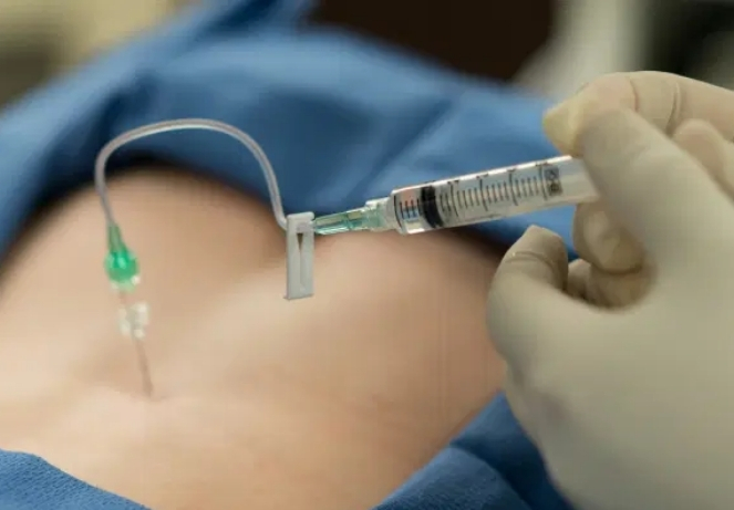 Image-Guided Spinal Injections