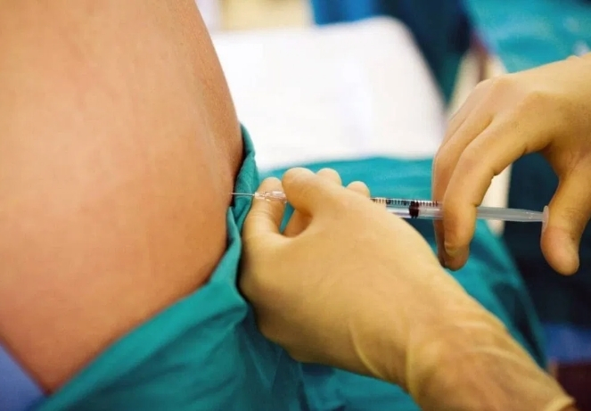 During the Procedure​