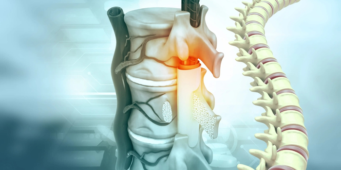 Understanding the Spinal Stenosis
