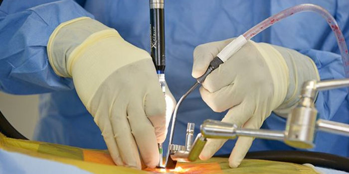 Minimally Invasive Spine Surgery