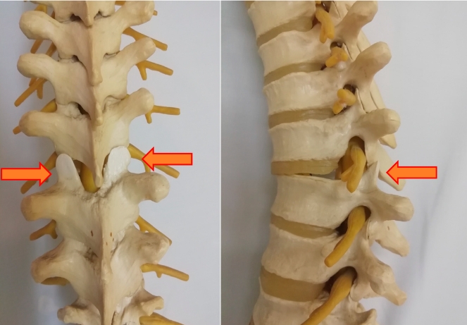 Fracture Dislocation Injuries
