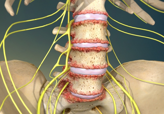 Soft tissue and ligament