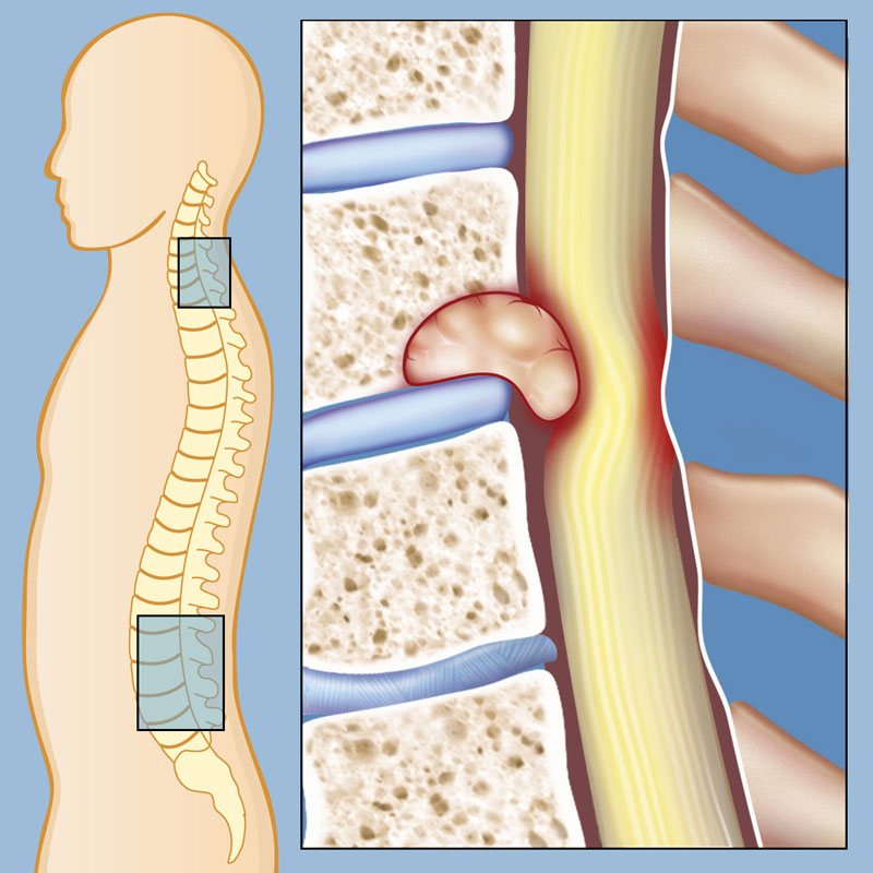 Surgical options performed by Dr. Rohit Thaker include